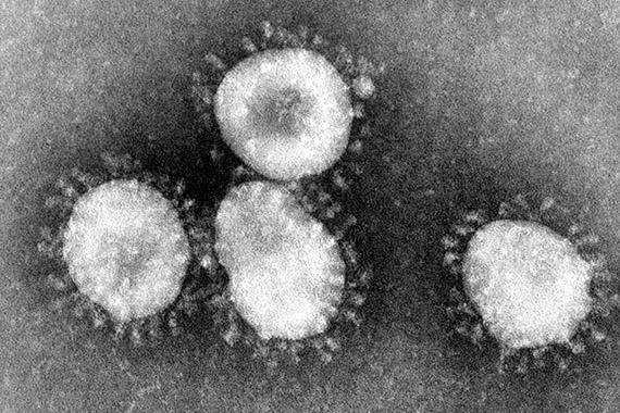 Coronavirus i elektronmikroskop.