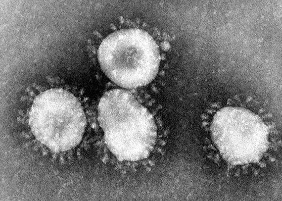 Bilder som denna, tagna av coronavirus i elektronmikroskop, påminner om den ljuskrans vi ser runt solen vid solförmörkelse och som kallas just korona, och därav namnet på viruset. Foto: Wikimedia Commons, CDC/Dr. Fred Murphy